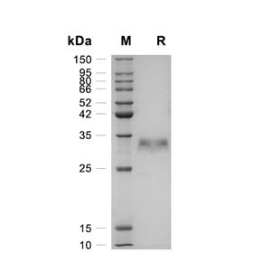 Cathepsin L1蛋白, Human (HEK293, C-His)