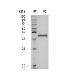 Cathepsin Z/CTSZ蛋白, Human (HEK293, C-His)