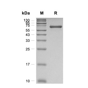 SHP-2蛋白, Human (T253M, Q257L, His)