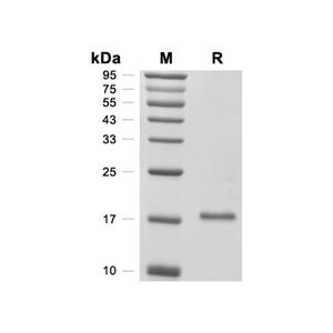 LMW-PTP/ACP1蛋白, Human (C-His),LMW-PTP/ACP1 Protein, Human (C-His)