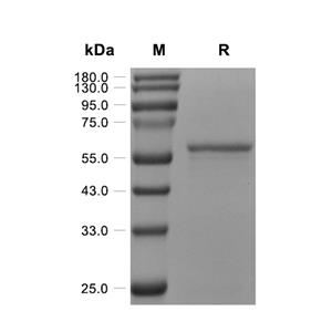 GOLM1蛋白, Human (His, Solution)