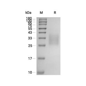 ACVR2A/Activin RIIA蛋白, Human/Cynomolgus (HEK293, His)