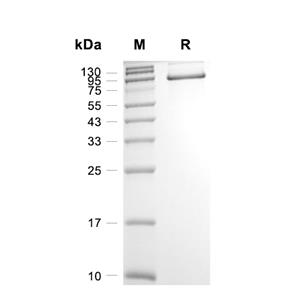 GAS6蛋白, Mouse (HEK293, His)