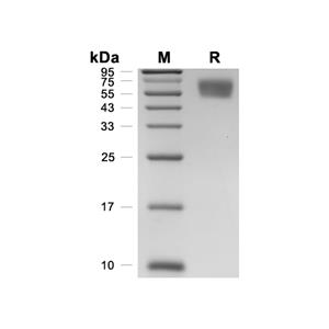 Apolipoprotein H/APOH蛋白, Mouse (HEK293, His)