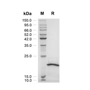 CD20/MS4A1蛋白, Human (Trx-His),CD20/MS4A1 Protein, Human (Trx-His)