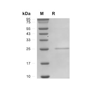 Bcl-2-like蛋白 11蛋白, Human (His)