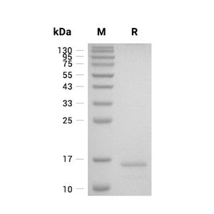 Cathepsin C/DPPI蛋白, Mouse (Inactive, His-Myc)