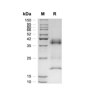 RPRD1B蛋白, Human (HEK293, N-His),RPRD1B Protein, Human (HEK293, N-His)