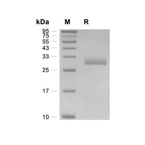 Angiopoietin-1蛋白, Mouse (HEK293, His)