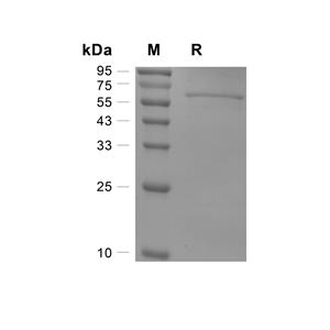 Aldolase B蛋白, Human (GST),Aldolase B Protein, Human (GST)