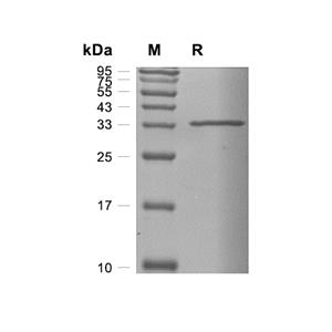 IdeS蛋白, Streptococcus pyogenes (N-His)