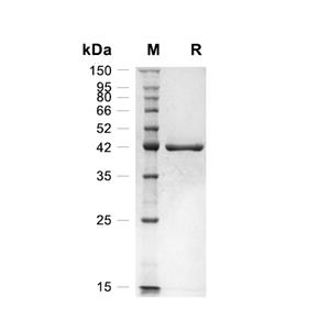 TCN2/Transcobalamin-2蛋白, Mouse (HEK293, C-His)