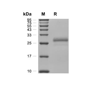 IFN-lambda 2/IL-28A蛋白, Mouse (HEK293, N-His)