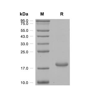 IFN-alpha 2/IFNA2蛋白, Mouse (His)