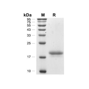 IL-1 beta蛋白, Human (N-His)