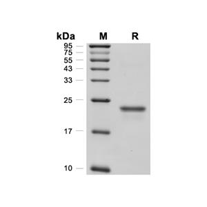 FGF-12蛋白, Human (181a.a, His)