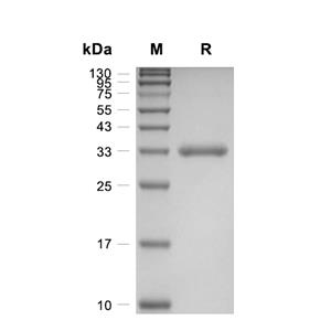 RANKL/TNFSF11蛋白, Mouse (HEK293, N-His)