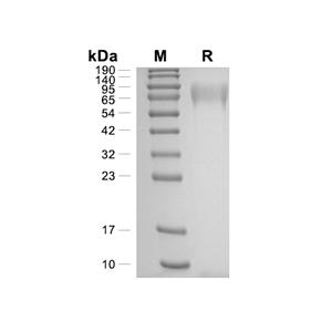 TPO/Thrombopoietin蛋白, Human (HEK293, C-His)