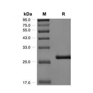 Tenascin/Tnc蛋白, Mouse (HEK293, His-Myc, solution)