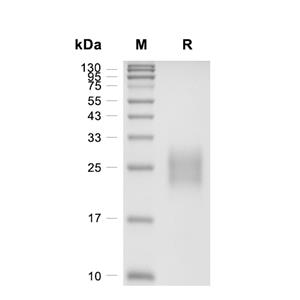 GIPR蛋白, Human (HEK293, His)