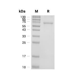 PRKN蛋白, Human (His, SUMO),PRKN Protein, Human (His, SUMO)
