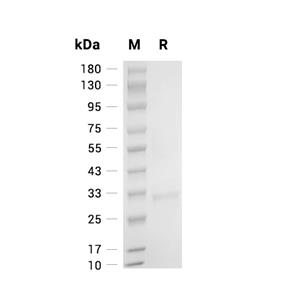 Granzyme K蛋白, Mouse (His, Myc),Granzyme K Protein, Mouse (His, Myc)