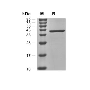 OGG1蛋白, Human (N-His)
