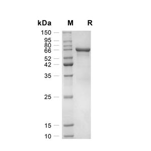 HSPA8/HSC70蛋白, Human (N-His)