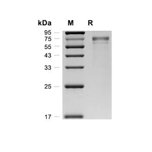 PPM1H蛋白, Human (HEK293, His)