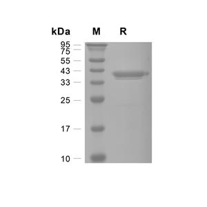 PTGR1蛋白, Human (HEK293, His),PTGR1 Protein, Human (HEK293, His)