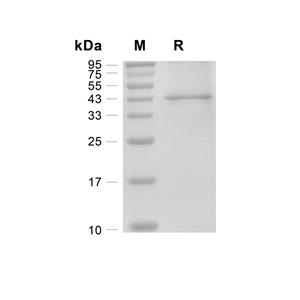 BMI1蛋白, Human (His)