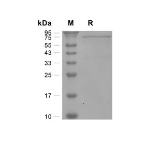 HNRNPM蛋白, Human (N-His)