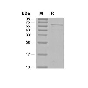 TFEB蛋白, Human (N-His)