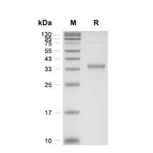 THBS1蛋白, Mouse (His)