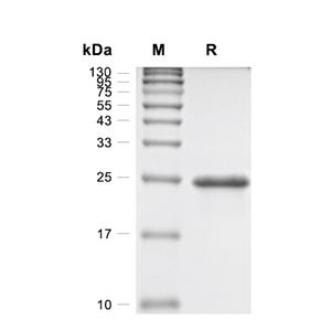 CIB2蛋白, Human (N-His)