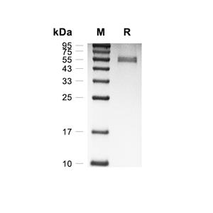 LDLRAD3蛋白, Human (HEK293, hFc),LDLRAD3 Protein, Human (HEK293, hFc)
