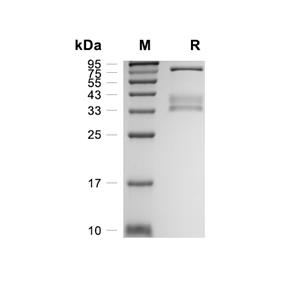 RON/MSPR蛋白, Human (HEK293, C-His)