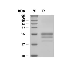 TL1A/TNFSF15蛋白, Human (161a.a, HEK293, His)