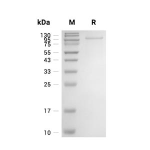 FBLN1蛋白, Human (HEK293, His, Myc)
