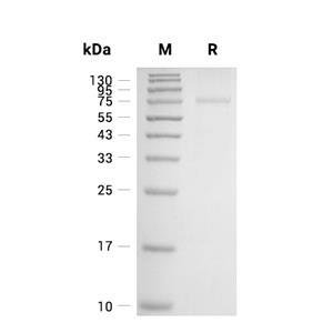 HDAC10蛋白, Human (His)