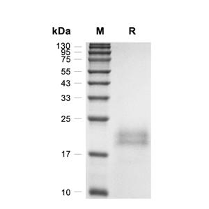TDGF1蛋白, Mouse (HEK293, His)