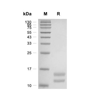 S100A8-S100A9 Heterodimer蛋白, Human (His)