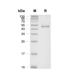 Complement factor H/CFH蛋白, Human (431a.a, HEK293, C-His)