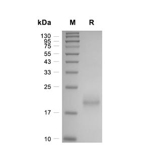 Kras4B蛋白, Human (N-His)