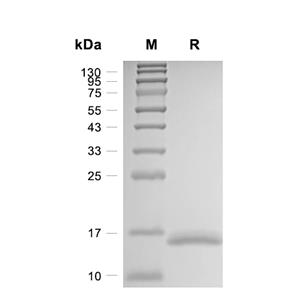 Calcitonin/CALCA蛋白, Human (His)