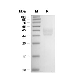 Kallikrein-5蛋白, Mouse (271a.a, HEK293, His)