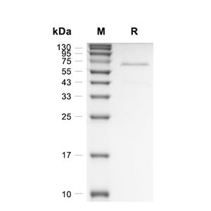 ADAM9蛋白, Human (HEK293, His),ADAM9 Protein, Human (HEK293, His)