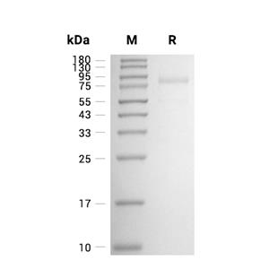 Plasma kallikrein/KLKB1蛋白, Mouse (HEK293, His)