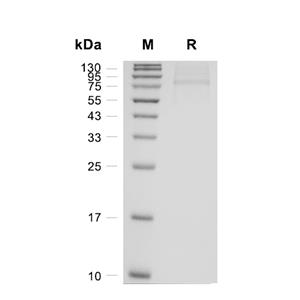 HNF4A蛋白, Human (HEK293, His)