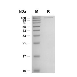 NASP蛋白, Human (HEK293, His)